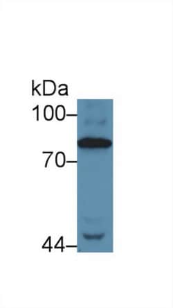 Invitrogen Complement C4 Polyclonal Antibody, Invitrogen 20 &mu;L; Unconjugated:Antibodies,
