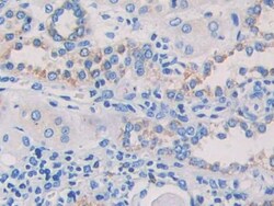 Invitrogen EB1 Polyclonal Antibody, Invitrogen:Antibodies:Primary Antibodies