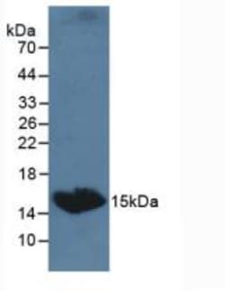 Invitrogen TSH beta Polyclonal Antibody, Invitrogen 20 &mu;L; Unconjugated:Antibodies,