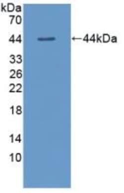 Invitrogen TSH beta Polyclonal Antibody, Invitrogen 20 &mu;L; Unconjugated:Antibodies,