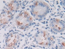LPHN3 Polyclonal Antibody, Invitrogen:Antibodies:Primary Antibodies