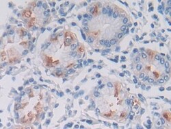 LPHN3 Polyclonal Antibody, Invitrogen:Antibodies:Primary Antibodies