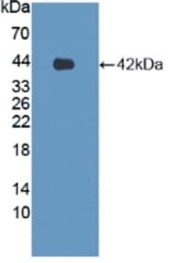 LPHN3 Polyclonal Antibody, Invitrogen:Antibodies:Primary Antibodies