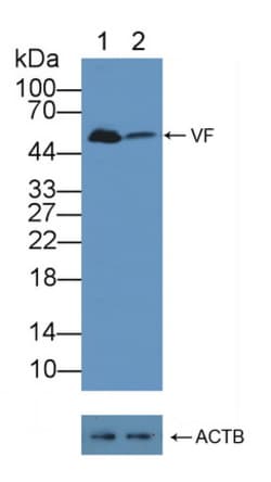 Invitrogen NAMPT Polyclonal Antibody, Invitrogen 20 &mu;L; Unconjugated:Antibodies,