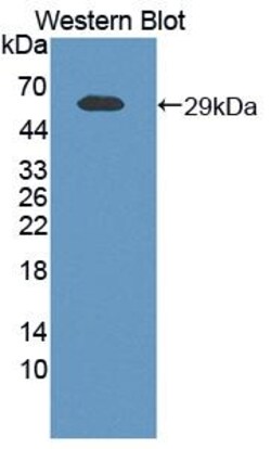 Invitrogen NAMPT Polyclonal Antibody, Invitrogen 20 &mu;L | Buy Online | Invitrogen&trade; | Fisher Scientific