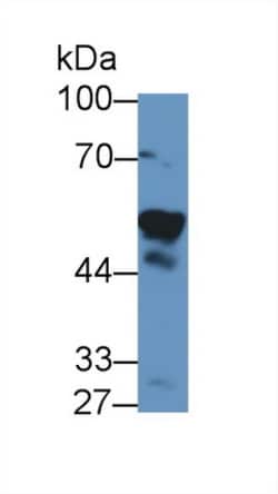 Invitrogen NAMPT Polyclonal Antibody, Invitrogen 20 &mu;L; Unconjugated:Antibodies,