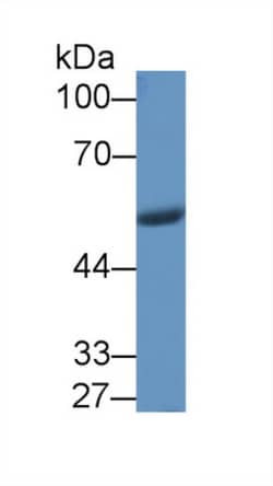 Invitrogen NAMPT Polyclonal Antibody, Invitrogen 20 &mu;L; Unconjugated:Antibodies,