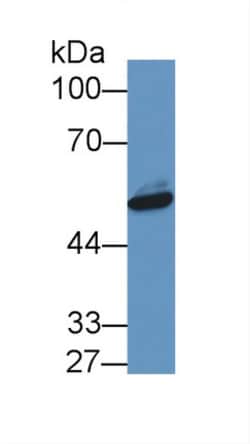 Invitrogen NAMPT Polyclonal Antibody, Invitrogen 20 &mu;L; Unconjugated:Antibodies,