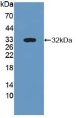 Invitrogen Nidogen 2 Polyclonal Antibody, Invitrogen 200 &mu;L; Unconjugated:Antibodies,
