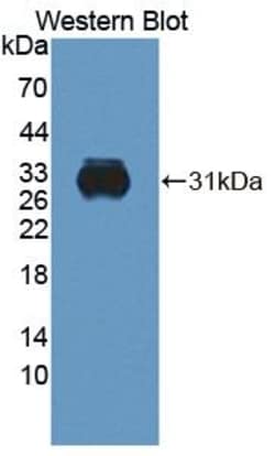 CELA2A Polyclonal Antibody, Invitrogen:Antibodies:Primary Antibodies