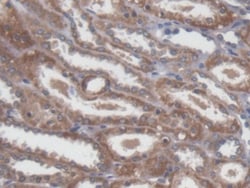 Invitrogen NME5 Polyclonal Antibody, Invitrogen 20 &mu;L | Buy Online | Invitrogen&trade; | Fisher Scientific