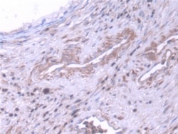 Invitrogen NME5 Polyclonal Antibody, Invitrogen 20 &mu;L | Buy Online | Invitrogen&trade; | Fisher Scientific