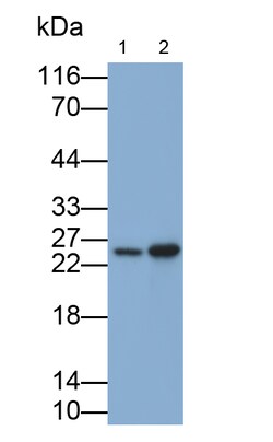 Invitrogen NME5 Polyclonal Antibody, Invitrogen 20 &mu;L | Buy Online | Invitrogen&trade; | Fisher Scientific