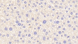 Invitrogen Complement C4b Polyclonal Antibody, Invitrogen:Antibodies:Primary