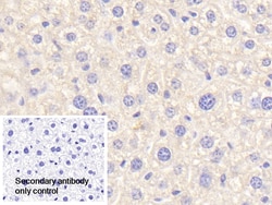 Invitrogen Complement C4b Polyclonal Antibody, Invitrogen 200 &mu;L; Unconjugated:Antibodies,