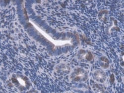Invitrogen GBP4 Polyclonal Antibody, Invitrogen 200 &mu;L; Unconjugated:Antibodies,