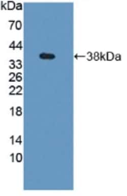 Invitrogen GBP4 Polyclonal Antibody, Invitrogen 200 &mu;L; Unconjugated:Antibodies,