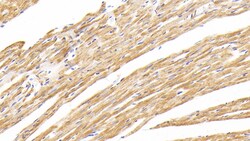 Invitrogen MTCO2 Polyclonal Antibody, Invitrogen 20 &mu;L; Unconjugated:Antibodies,