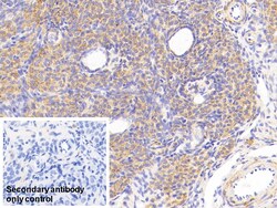 Invitrogen MTCO2 Polyclonal Antibody, Invitrogen 20 &mu;L; Unconjugated:Antibodies,
