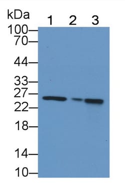 Invitrogen MTCO2 Polyclonal Antibody, Invitrogen 20 &mu;L; Unconjugated:Antibodies,