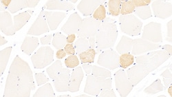 Myosin heavy chain 1 Polyclonal Antibody, Invitrogen:Antibodies:Primary