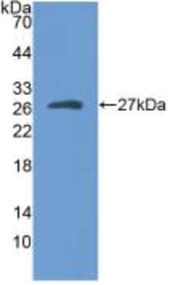 Myosin heavy chain 1 Polyclonal Antibody, Invitrogen:Antibodies:Primary