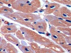 Invitrogen ICAM-1 Polyclonal Antibody, Invitrogen 200 &mu;L; Unconjugated:Antibodies,