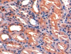 Invitrogen ICAM-1 Polyclonal Antibody, Invitrogen 200 &mu;L; Unconjugated:Antibodies,