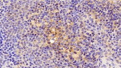 Invitrogen ICAM-1 Polyclonal Antibody, Invitrogen 200 &mu;L; Unconjugated:Antibodies,