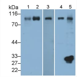 Invitrogen ICAM-1 Polyclonal Antibody, Invitrogen 200 &mu;L; Unconjugated:Antibodies,