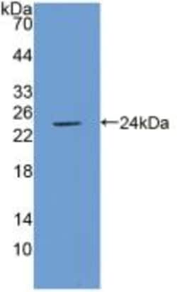 Invitrogen ICAM-1 Polyclonal Antibody, Invitrogen 200 &mu;L; Unconjugated:Antibodies,