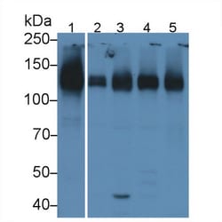 Invitrogen ICAM-1 Polyclonal Antibody, Invitrogen 200 &mu;L; Unconjugated:Antibodies,