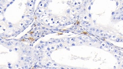 Invitrogen Hemoglobin Polyclonal Antibody, Invitrogen:Antibodies:Primary