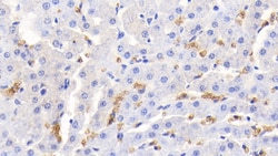 Invitrogen Hemoglobin Polyclonal Antibody, Invitrogen:Antibodies:Primary