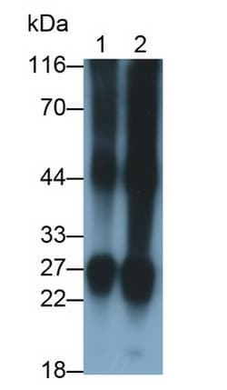 Invitrogen CRYBB2 Polyclonal Antibody, Invitrogen 200 &mu;L; Unconjugated:Antibodies,