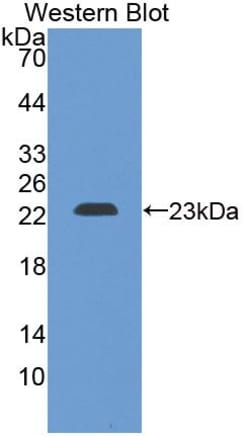 Invitrogen CRYBB2 Polyclonal Antibody, Invitrogen 200 &mu;L; Unconjugated:Antibodies,