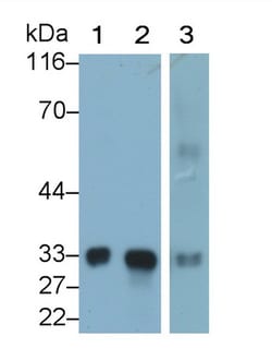 Invitrogen MBL2 Polyclonal Antibody, Invitrogen 20 &mu;L; Unconjugated:Antibodies,