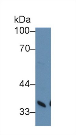 PTK9 Polyclonal Antibody, Invitrogen:Antibodies:Primary Antibodies
