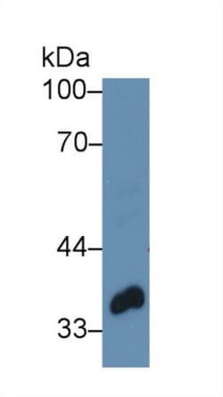 PTK9 Polyclonal Antibody, Invitrogen:Antibodies:Primary Antibodies