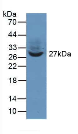 PTK9 Polyclonal Antibody, Invitrogen:Antibodies:Primary Antibodies