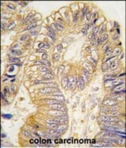 Invitrogen CLIC5 Polyclonal Antibody 400 &mu;L; Unconjugated:Antibodies,