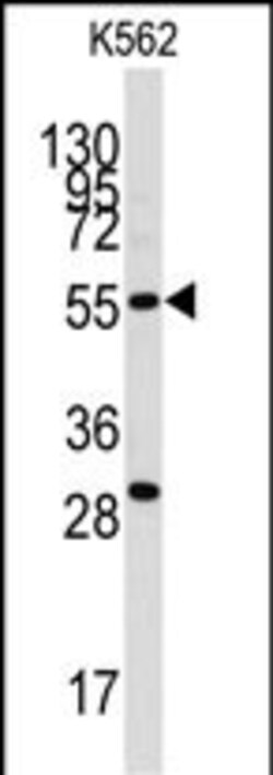 Invitrogen CLIC5 Polyclonal Antibody 400 &mu;L; Unconjugated:Antibodies,