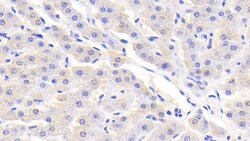 Invitrogen RBP5 Polyclonal Antibody, Invitrogen 200 &mu;L; Unconjugated:Antibodies,