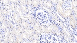 Invitrogen RBP5 Polyclonal Antibody, Invitrogen 200 &mu;L; Unconjugated:Antibodies,