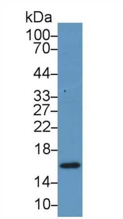 Invitrogen RBP5 Polyclonal Antibody, Invitrogen 200 &mu;L; Unconjugated:Antibodies,