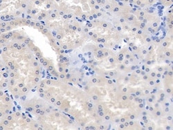 Invitrogen ANGPTL1 Polyclonal Antibody, Invitrogen 20 &mu;L; Unconjugated:Antibodies,