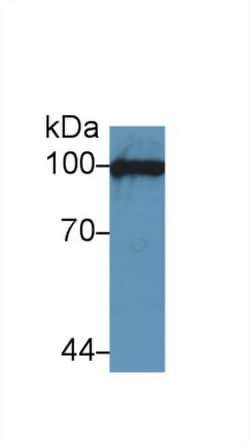 VCAM-1 Polyclonal Antibody, Invitrogen:Antibodies:Primary Antibodies