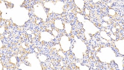 Invitrogen Hemoglobin Polyclonal Antibody, Invitrogen 200 &mu;L; Unconjugated:Antibodies,