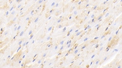 Invitrogen Hemoglobin Polyclonal Antibody, Invitrogen 200 &mu;L; Unconjugated:Antibodies,