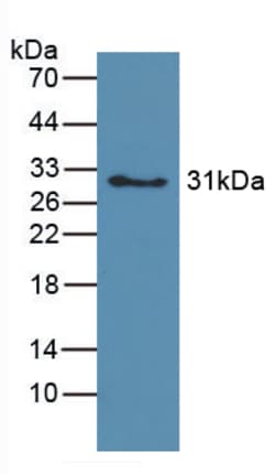 Invitrogen Hemoglobin Polyclonal Antibody, Invitrogen 20 &mu;L; Unconjugated:Anticorps,